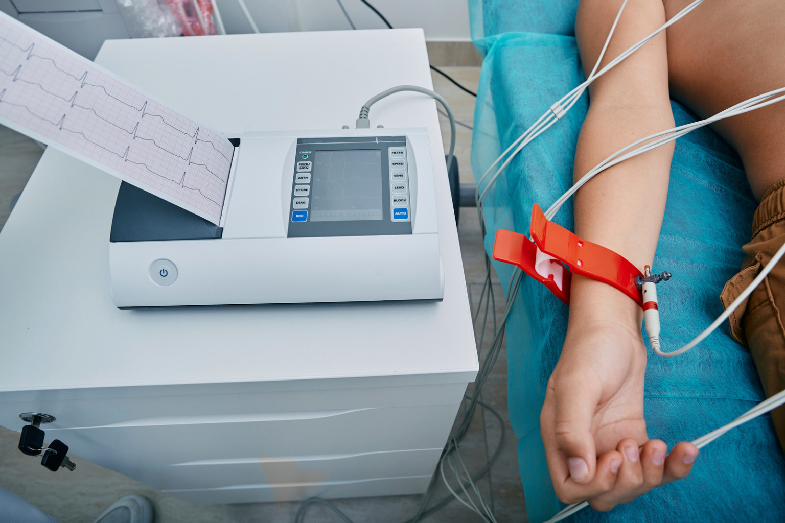 How Does an ECG Machine Help Healthcare Providers Detect Heart Problems ...